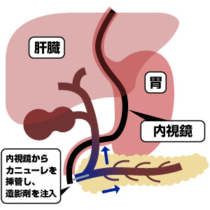 胆道・膵臓内視鏡検査